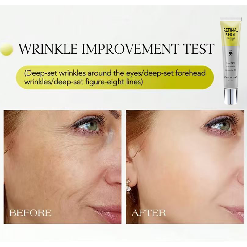 Retinal 0.1% Intensive Shot Pa - đánh giá và giá The Ordinary Serum Hyaluronic Acid